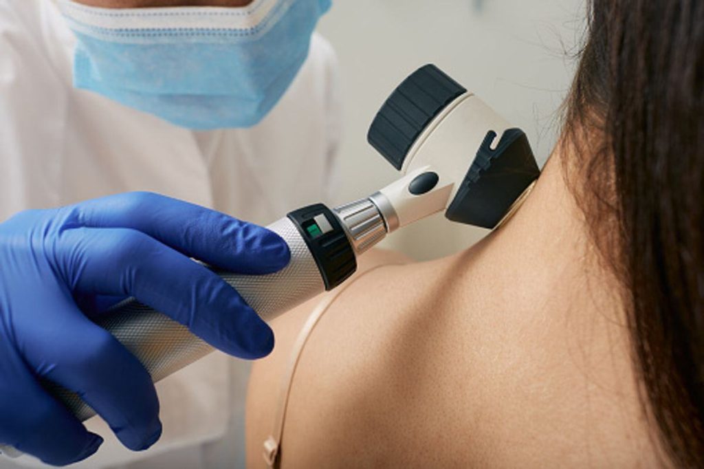 Sun Damage & Skin Cancer Risks