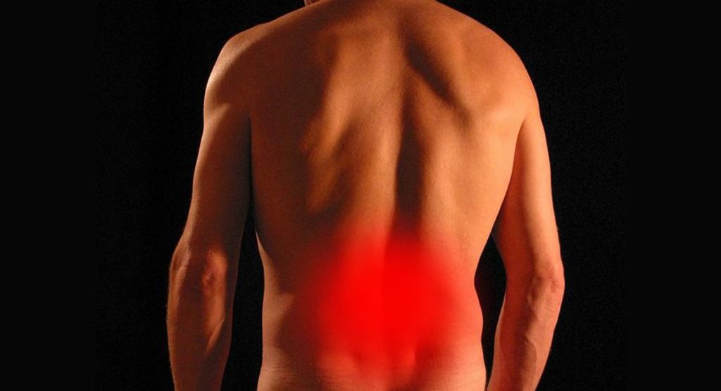 What Sciatica Is