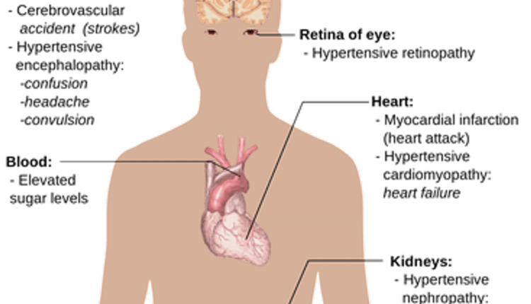 How Protein Affects High Blood Pressure