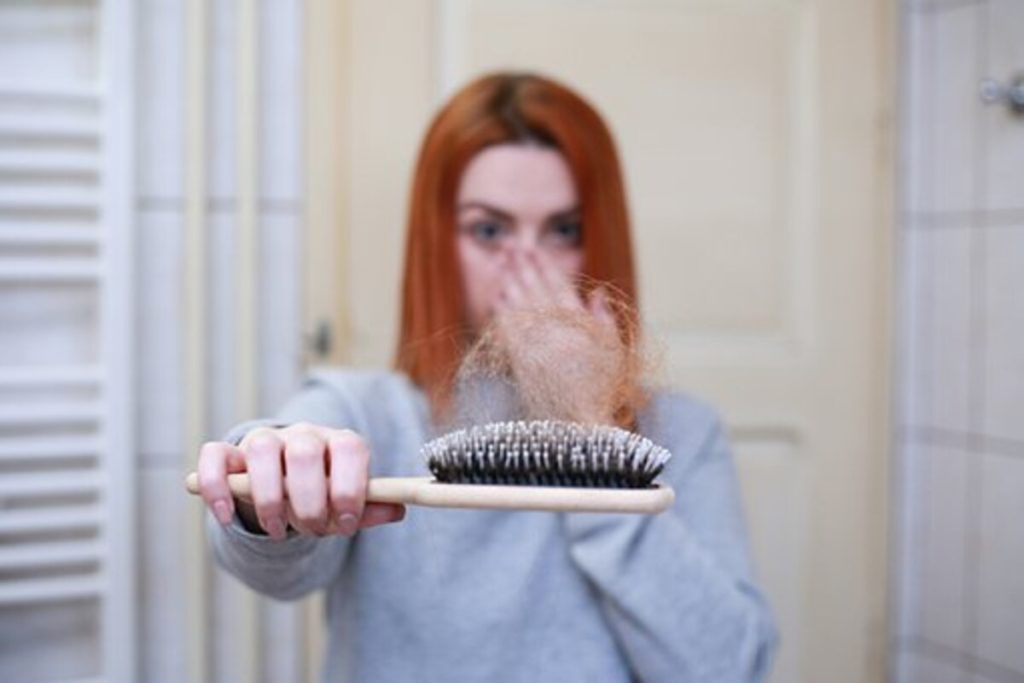 Androgenetic Alopecia