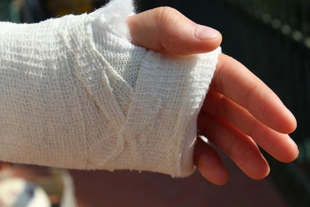 Sprained Foot