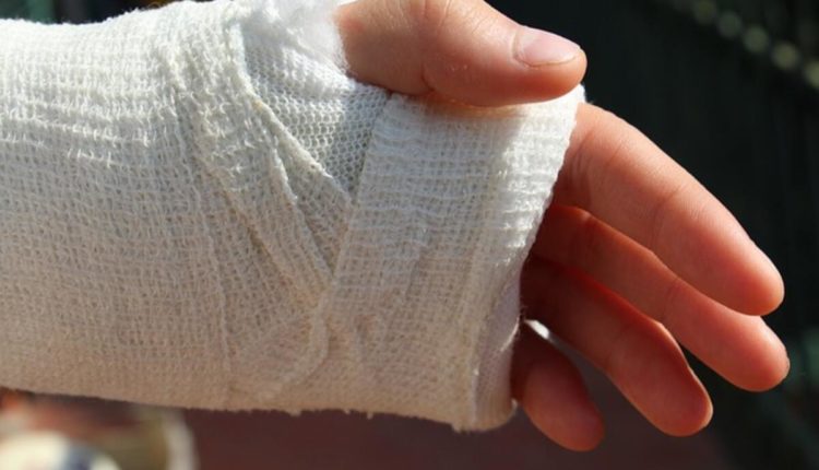 Sprained Foot