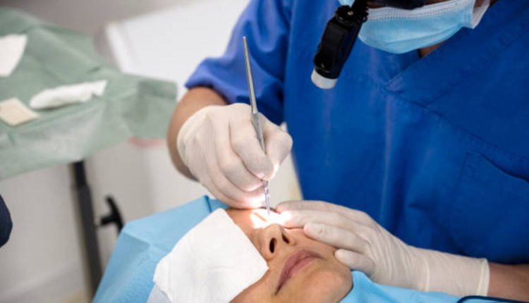 بلفاروپلاستی پلک