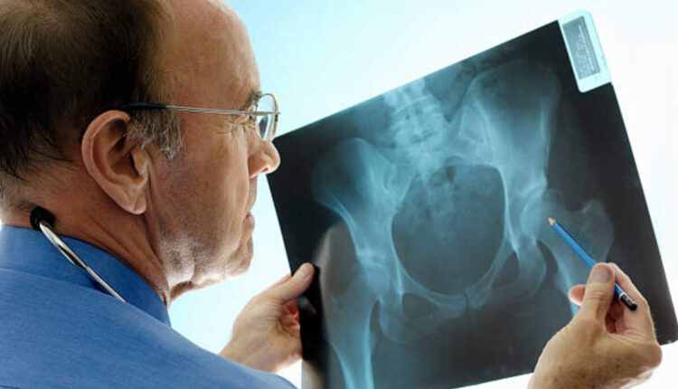 orthopedic surgeons in Fort Worth